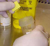 Specimen Pot in a Laboratory