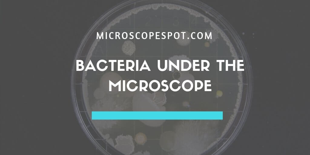 Bacteria Under the Microscope - MicroscopeSpot Bacteria Under the Microscope