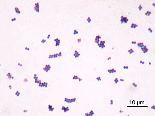 Staphylococcus Aureus