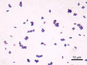 Staphylococcus_aureus_Gram - MicroscopeSpot - MicroscopeSpot